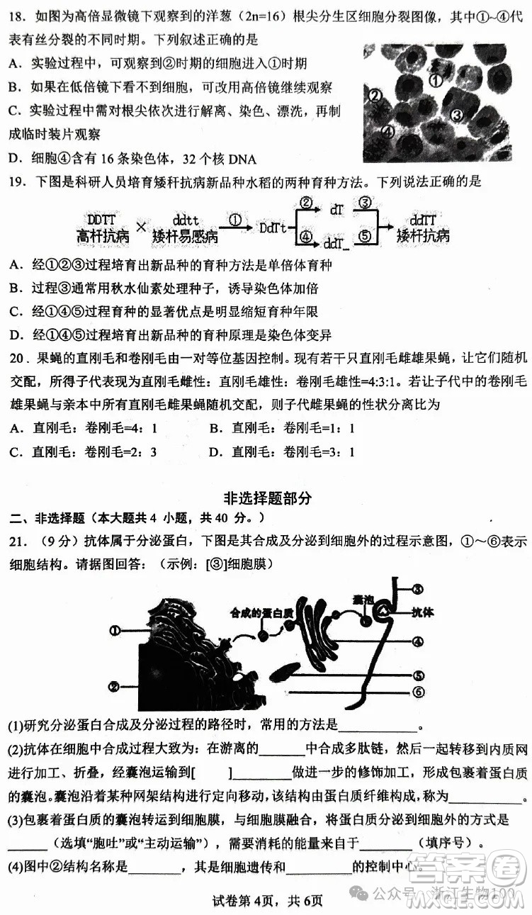 ?2025年6月慈溪高一期末考試生物試卷答案